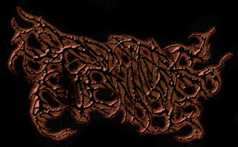 Spontaneous Curettage